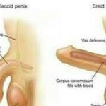 La faiblesse sexuelle